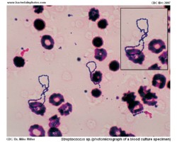 viridans streptococci micrograph